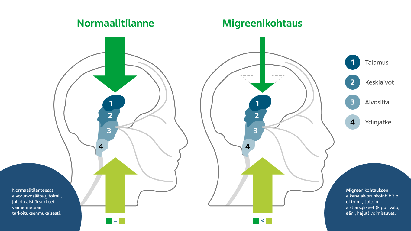 Aivorungon tasapainotilanteen muutos migreenikohtauksen aikana